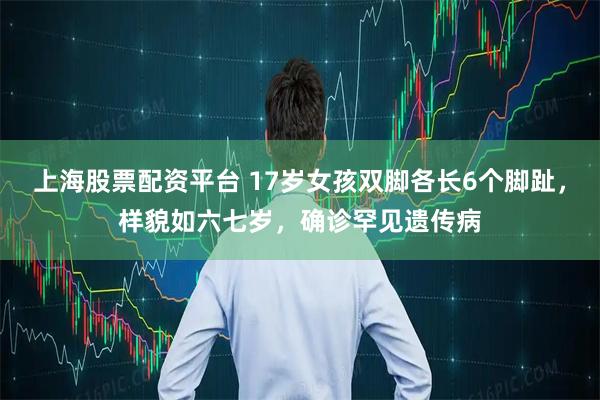 上海股票配资平台 17岁女孩双脚各长6个脚趾，样貌如六七岁，确诊罕见遗传病